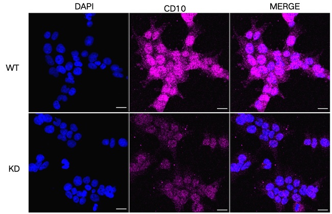 PIP5K1C Antibody in Immunocytochemistry (ICC/IF)