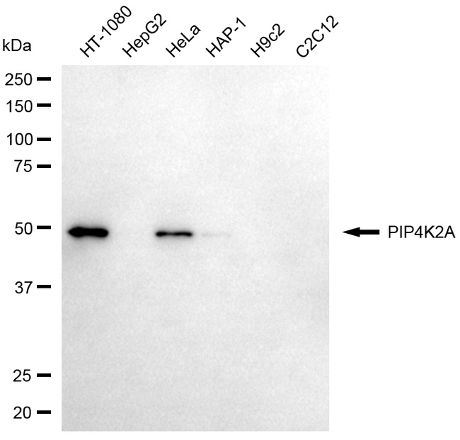 PIP4K2A Antibody in Western Blot (WB)