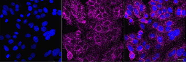 PIK3C2A Antibody in Immunocytochemistry (ICC/IF)