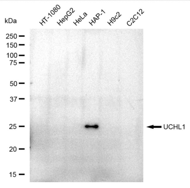 PGP9.5 Antibody in Western Blot (WB)