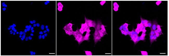 PGP9.5 Antibody in Immunocytochemistry (ICC/IF)