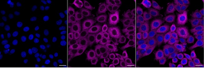 PFKP Antibody in Immunocytochemistry (ICC/IF)