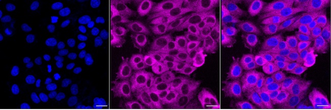 PFKP Antibody in Immunocytochemistry (ICC/IF)