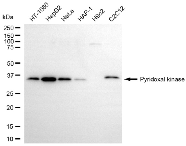 PDXK Antibody in Western Blot (WB)