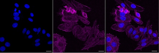 PDLIM7 Antibody in Immunocytochemistry (ICC/IF)