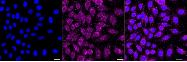 PCSK9 Antibody in Immunocytochemistry (ICC/IF)