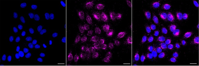 PCSK9 Antibody in Immunocytochemistry (ICC/IF)