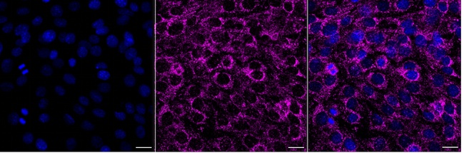 PCCA Antibody in Immunocytochemistry (ICC/IF)