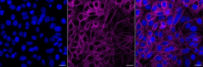 PACSIN3 Antibody in Immunocytochemistry (ICC/IF)