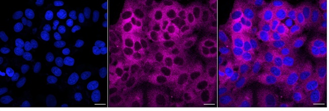 PACSIN3 Antibody in Immunocytochemistry (ICC/IF)