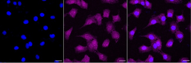 p70 S6 Kinase Antibody in Immunocytochemistry (ICC/IF)