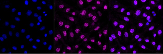 p53DINP1 Antibody in Immunocytochemistry (ICC/IF)