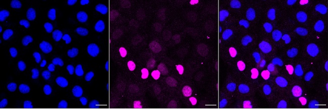 p21 Antibody in Immunocytochemistry (ICC/IF)
