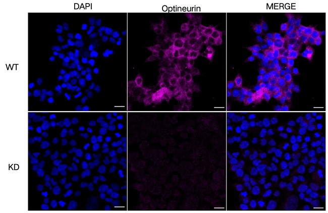 Optineurin Antibody in Immunocytochemistry (ICC/IF)