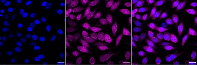 Oncostatin M Antibody in Immunocytochemistry (ICC/IF)