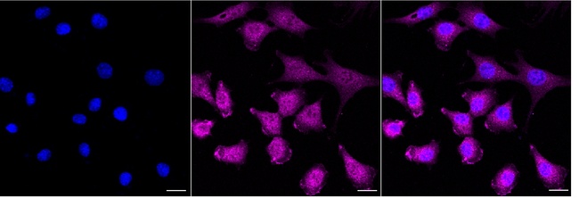 OGT Antibody in Immunocytochemistry (ICC/IF)