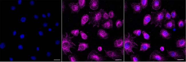 NPC2 Antibody in Immunocytochemistry (ICC/IF)