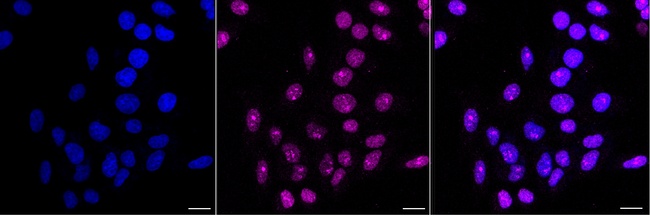 NOLA3 Antibody in Immunocytochemistry (ICC/IF)