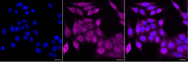 NME3 Antibody in Immunocytochemistry (ICC/IF)