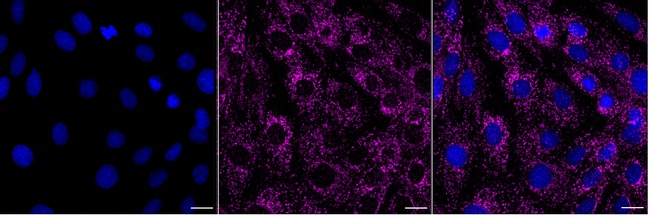 NLN Antibody in Immunocytochemistry (ICC/IF)