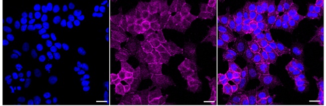 NF2 Antibody in Immunocytochemistry (ICC/IF)