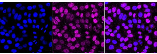 Nesprin 1 Antibody in Immunocytochemistry (ICC/IF)