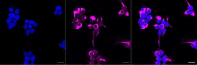 NF-M Antibody in Immunocytochemistry (ICC/IF)