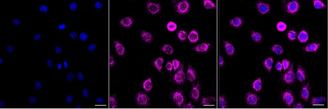 NDUFAF5 Antibody in Immunocytochemistry (ICC/IF)