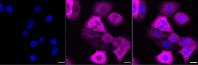 NDRG1 Antibody in Immunocytochemistry (ICC/IF)