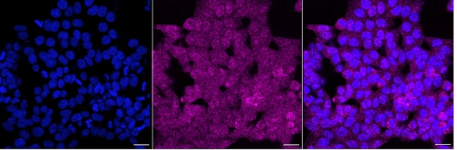 NCE2 Antibody in Immunocytochemistry (ICC/IF)