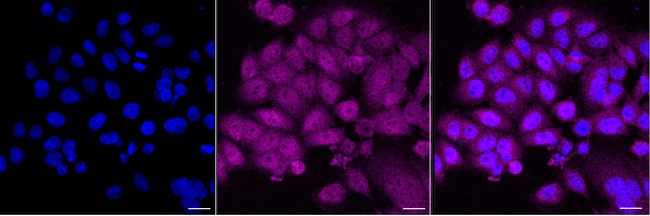 NAMPT Antibody in Immunocytochemistry (ICC/IF)