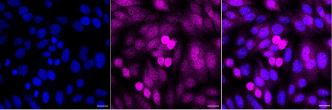 NAGK Antibody in Immunocytochemistry (ICC/IF)