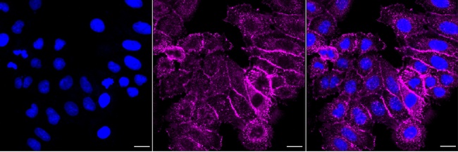MYO1B Antibody in Immunocytochemistry (ICC/IF)