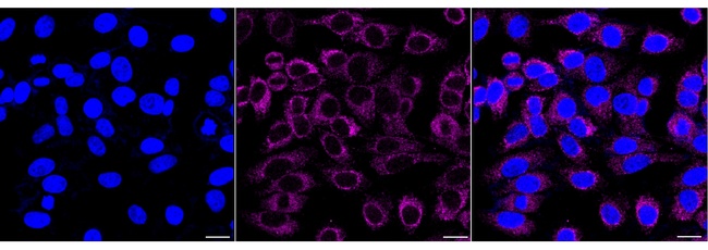 MYO19 Antibody in Immunocytochemistry (ICC/IF)