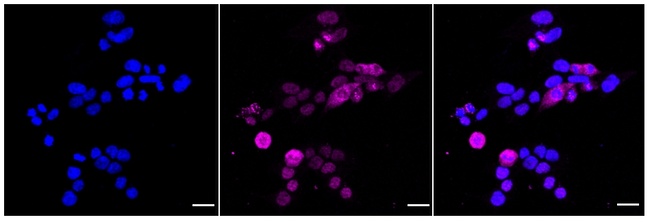 MyD88 Antibody in Immunocytochemistry (ICC/IF)