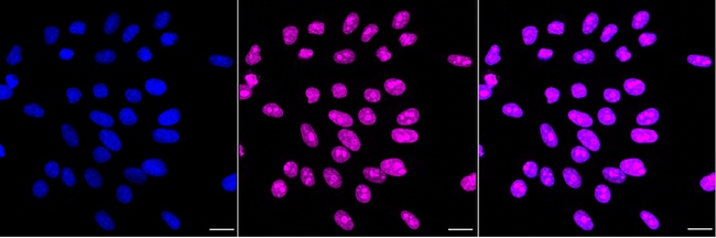 MYBBP1A Antibody in Immunocytochemistry (ICC/IF)