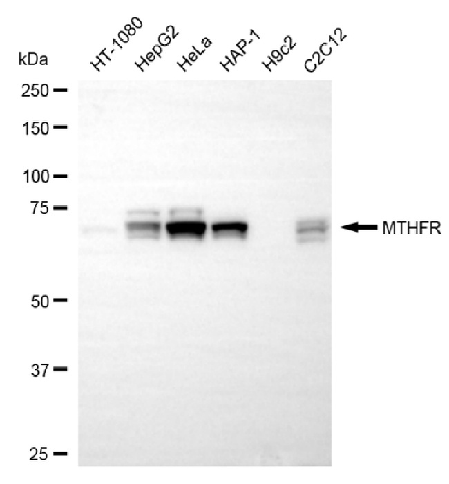 MTHFR Antibody in Western Blot (WB)