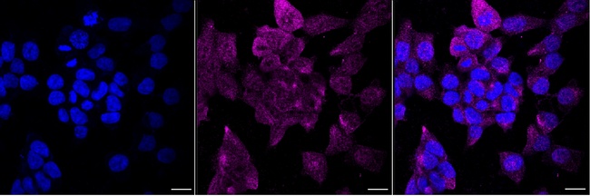 MSH2 Antibody in Immunocytochemistry (ICC/IF)