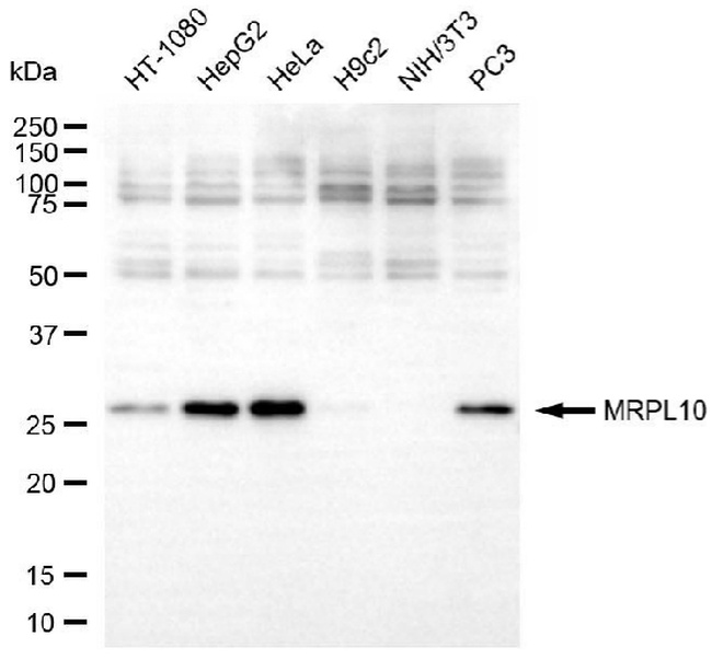 MRPL10 Antibody in Western Blot (WB)