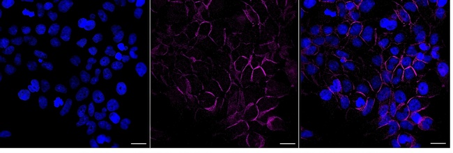 MRP1 Antibody in Immunocytochemistry (ICC/IF)