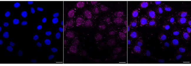 MARS Antibody in Immunocytochemistry (ICC/IF)
