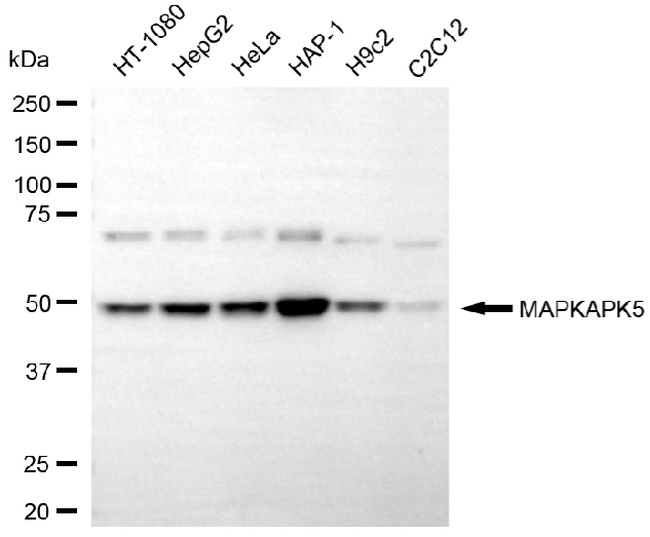 MAPKAPK5 Antibody in Western Blot (WB)
