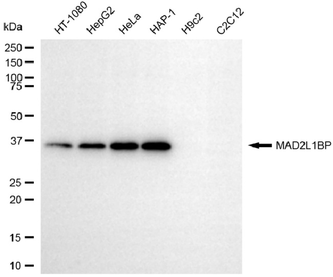 MAD2L1BP Antibody in Western Blot (WB)