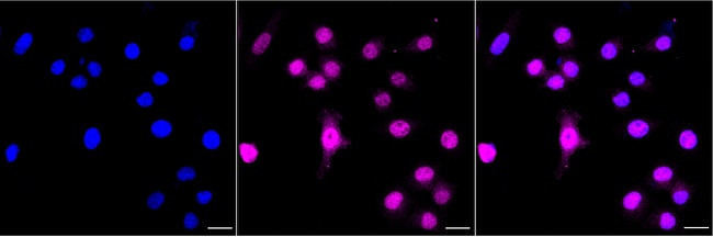 LSD1 Antibody in Immunocytochemistry (ICC/IF)