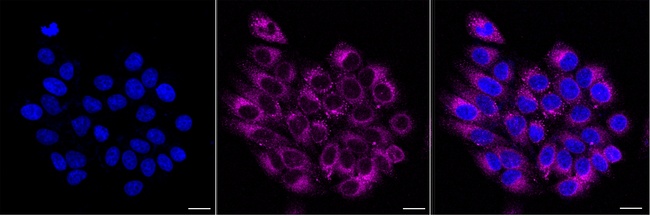 LPCAT1 Antibody in Immunocytochemistry (ICC/IF)