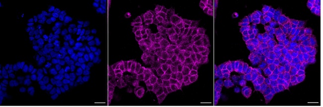 LLGL1 Antibody in Immunocytochemistry (ICC/IF)