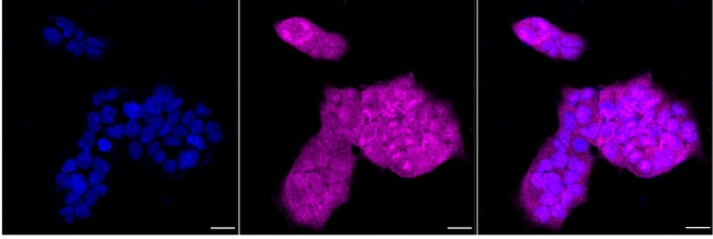 LIN28B Antibody in Immunocytochemistry (ICC/IF)