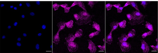 KRIT1 Antibody in Immunocytochemistry (ICC/IF)