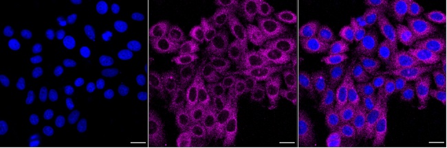 Kindlin 2 Antibody in Immunocytochemistry (ICC/IF)