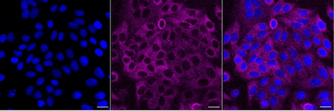 Kindlin 2 Antibody in Immunocytochemistry (ICC/IF)